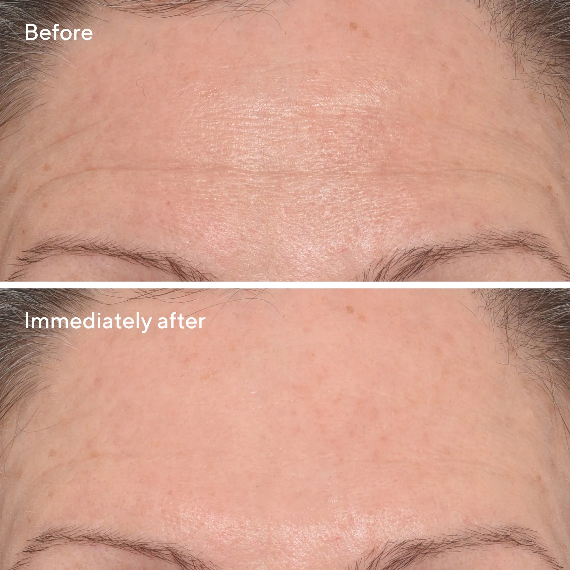 Targeted Wrinkle Corrector